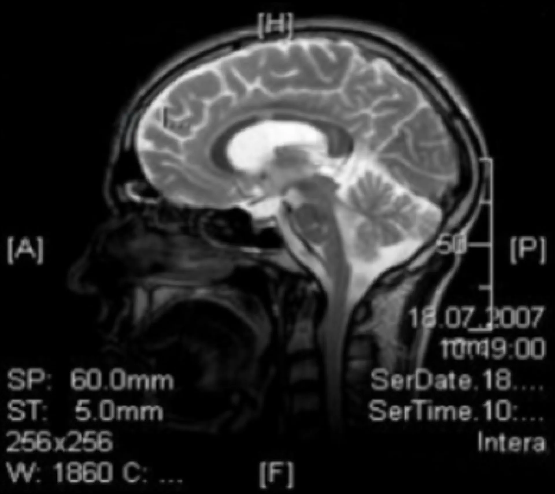 mrt_04.png.webp