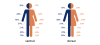 Grafik Schmerzlokalisation Männer und Frauen