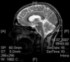 Abbildung eines Gehirns 