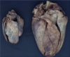 Normales vs Hypertrophes Herz